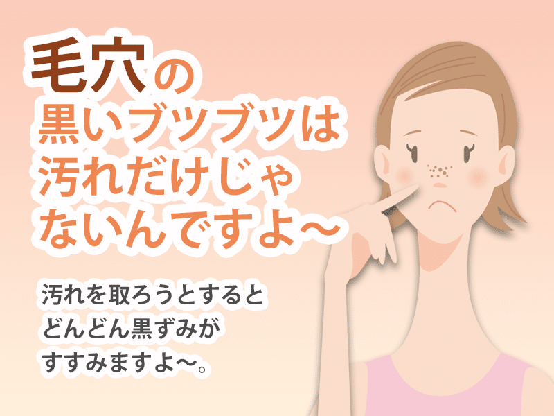 毛穴の黒いブツブツは 汚れだけじゃないんですよ スキンケアのシャレコ